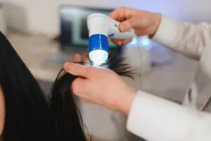 Expert Hair Loss Treatment in Cheshire