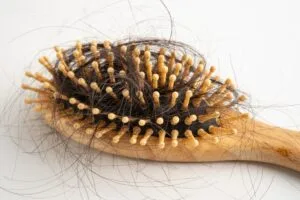 hypothyroidism and hair loss